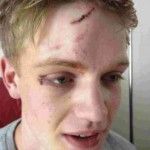 Joven heterosexual es agredido durante Orgullo de Brighton por hacer frente a matones homófobos