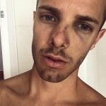 Un joven gay británico es brutalmente agredido en plena calle en Sitges