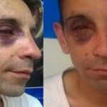 Argentina: Brutal agresión homófoba a un activista LGTB a manos de neonazis