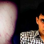 El escritor argelino Anouar Rahmani denuncia la agresión sufrida por un joven homosexual por parte de tres desconocidos que le propinaron latigazos